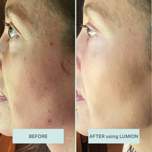 LUMION skin - Miracle Mist Refill with HOCL + Oxygen