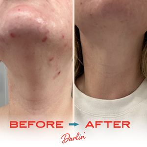 Darlin' Skincare | Tallow & Tansy Face Balm