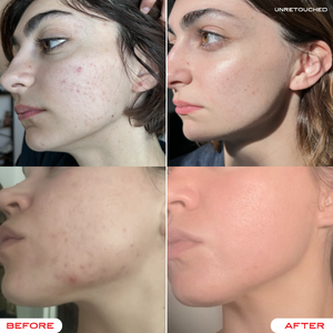 Darlin' Skincare | Tallow & Tansy Face Balm