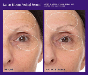 Ursa Major | Lunar Bloom Retinal Serum