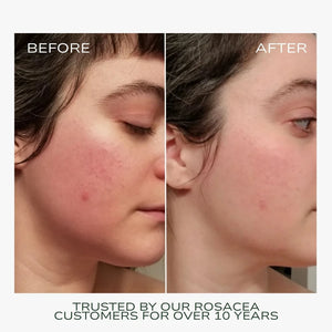 Fitglow Beauty Redness Rescue Cream (RRC)