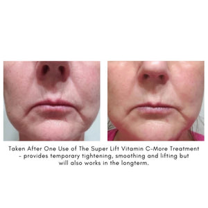 Maya Chia The Super Lift Vitamin C-More Treatment