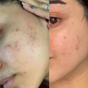 MARA Evening Primrose + Green Tea® Algae Retinol Face Oil