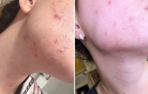 MARA Evening Primrose + Green Tea® Algae Retinol Face Oil