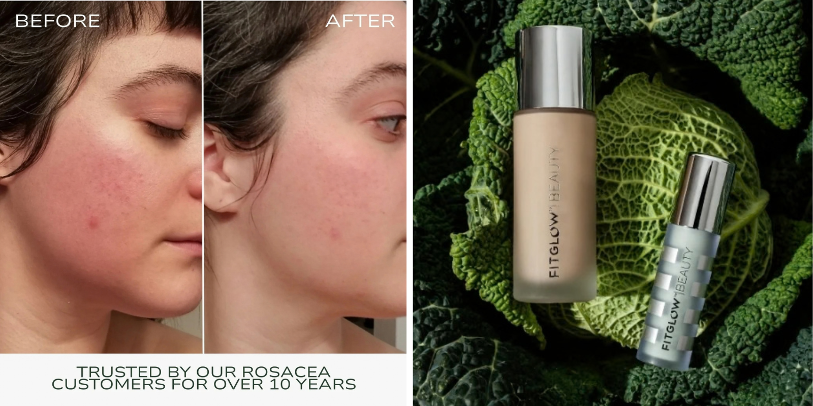 FITGLOW BEAUTY: An Expert Guide To Understanding And Neutralizing Facial Redness