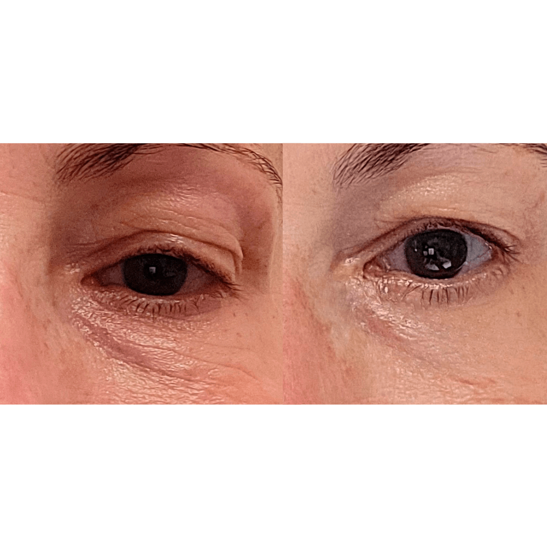 MAYA CHIA THE ADVANCED EYE RESPONSE COMPLEX RETINOL CREAM