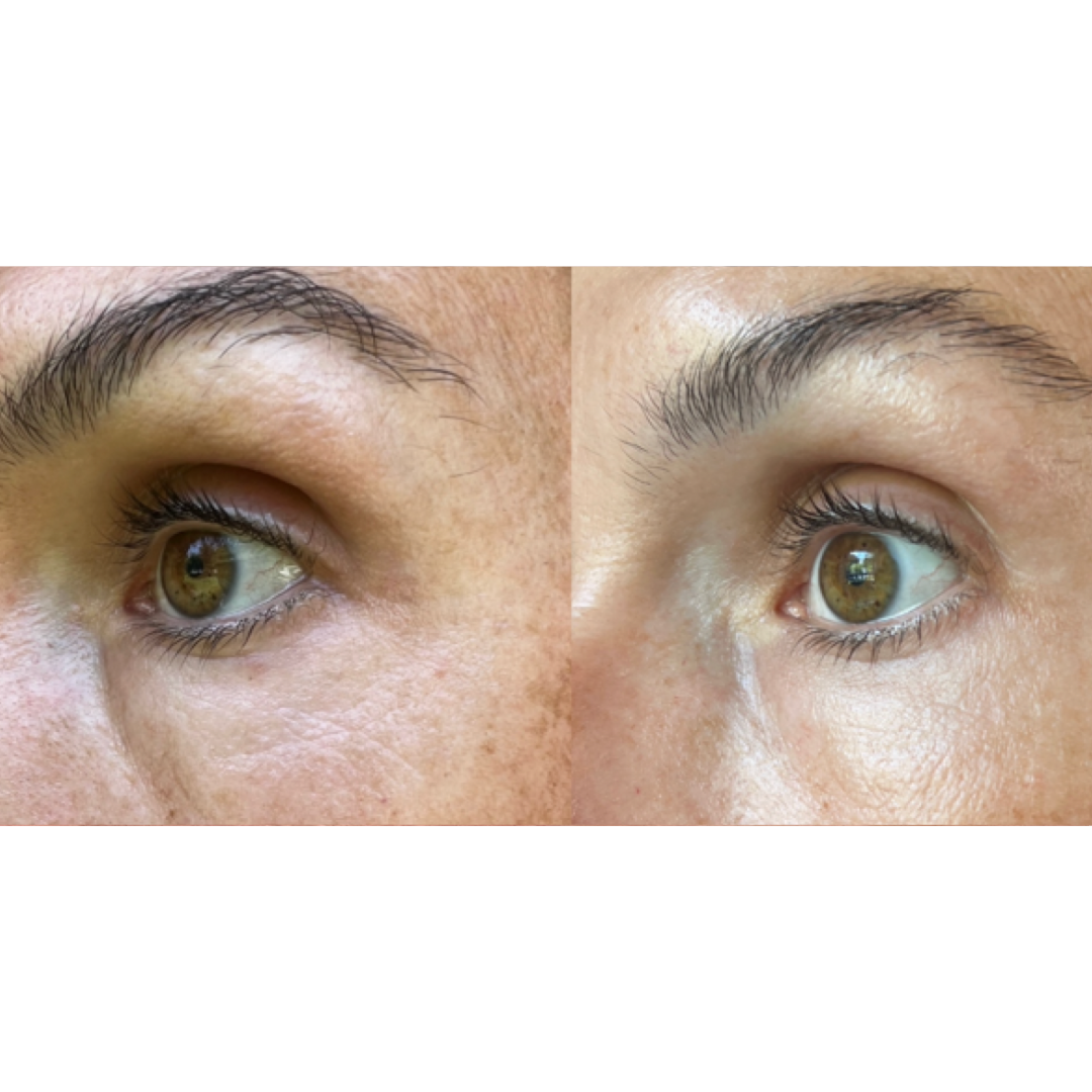 MAYA CHIA THE ADVANCED EYE RESPONSE COMPLEX RETINOL CREAM