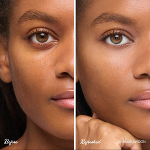 Before and after comparison of a woman's face with 'Before' and 'Refreshed' labels.