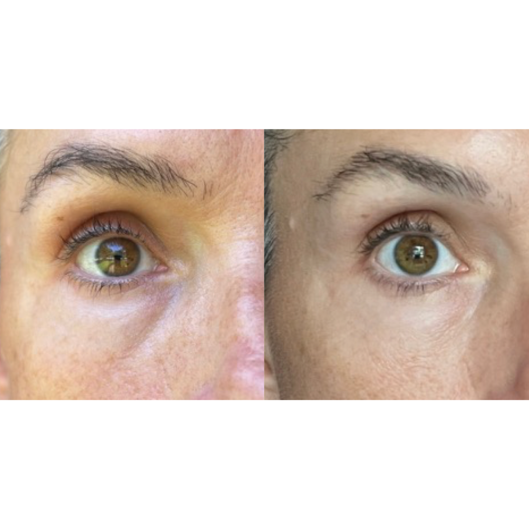 MAYA CHIA THE ADVANCED EYE RESPONSE COMPLEX RETINOL CREAM