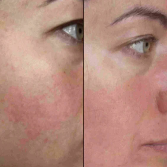 Maya Chia The Meringue Melt | Skin-Softening Cleanser