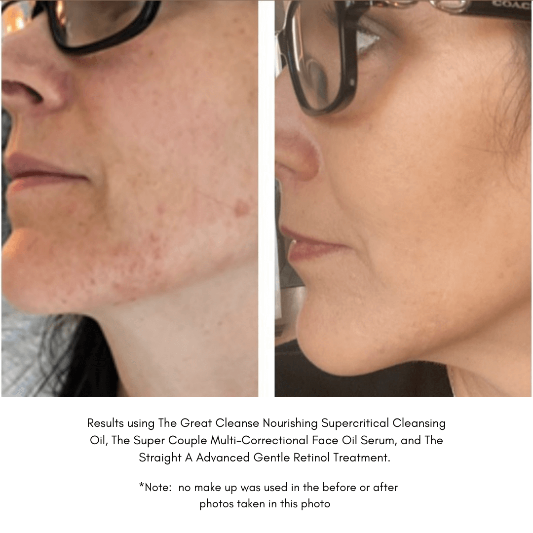 Maya Chia The Super Couple - Ultra Luxe Face Oil Serum