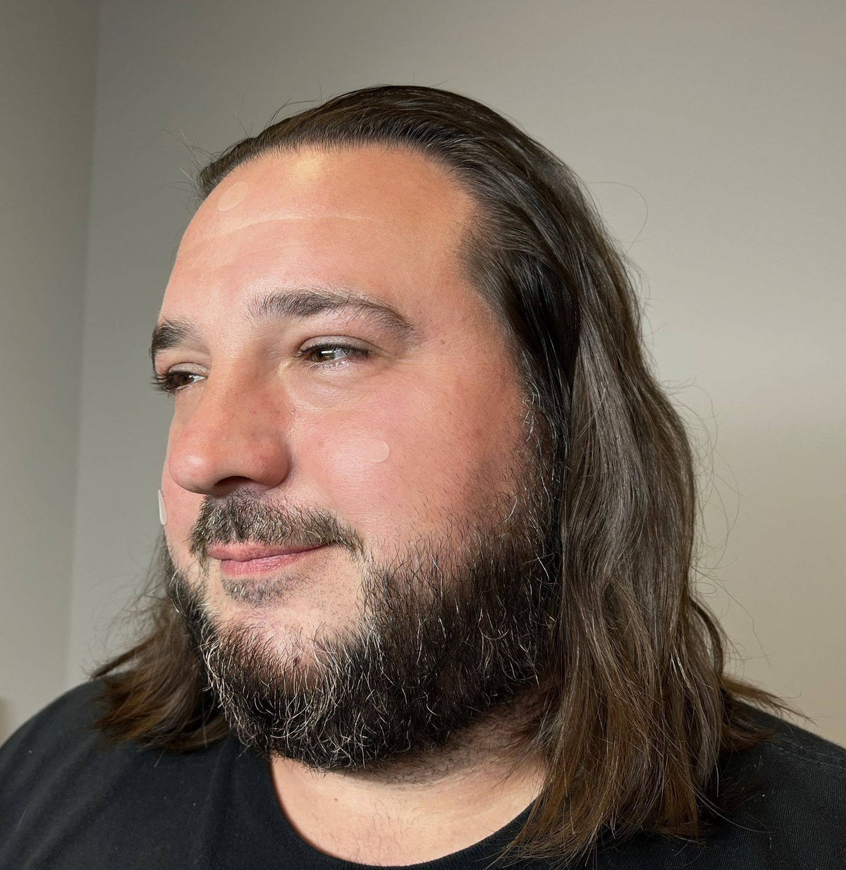 PatchAid - Pimple Patch - Advanced Acne Relief & Clear Skin