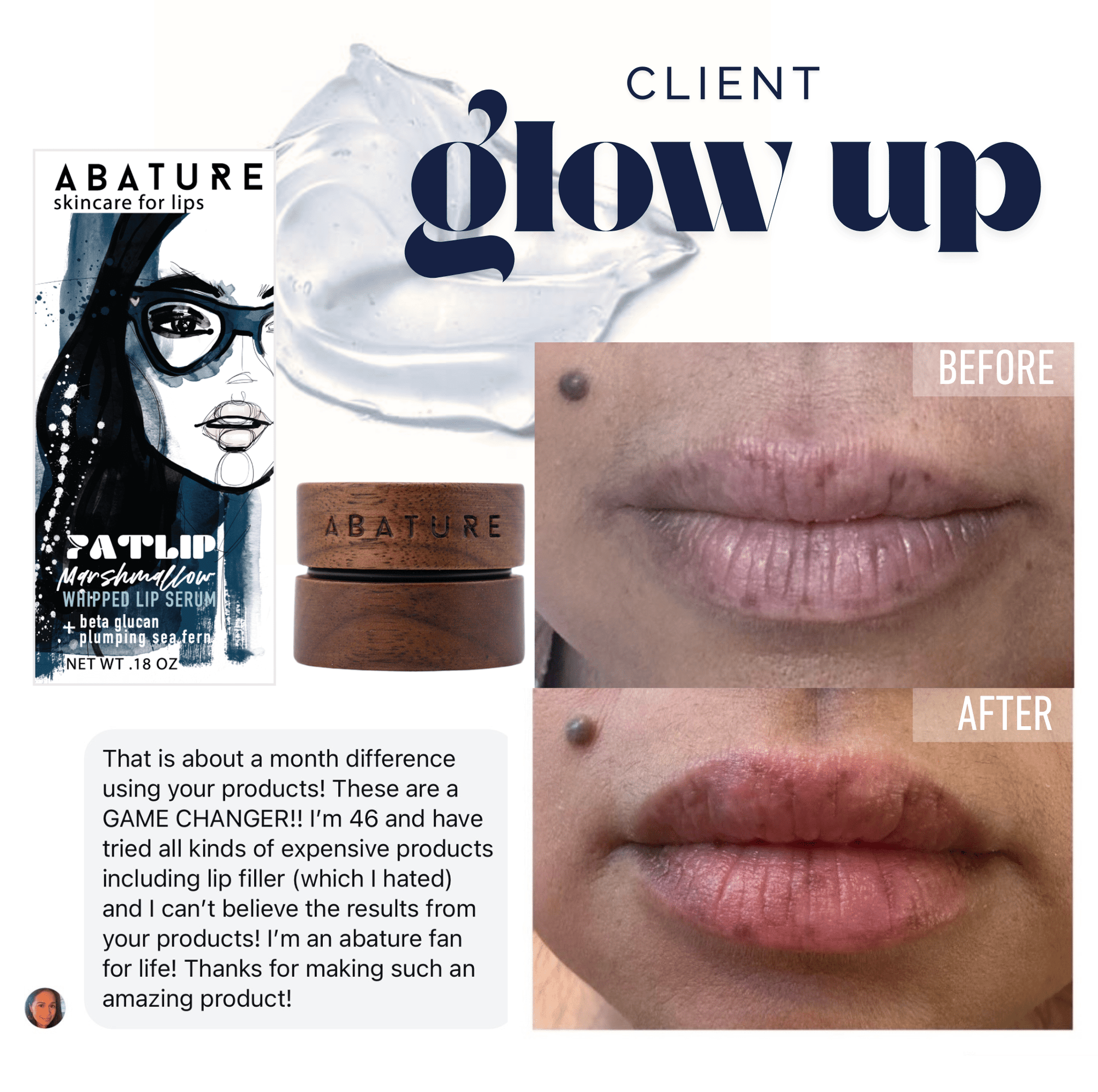 Abature Fat Lip Plumping Serum