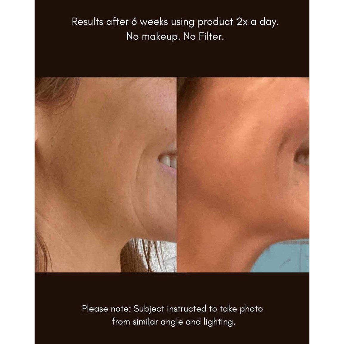 Maya Chia Advanced Response Complex | Regenerating Hydration Face & Neck Cream ~ Refill