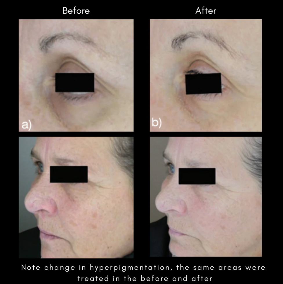 Maya Chia Advanced Response Complex | Regenerating Hydration Face & Neck Cream