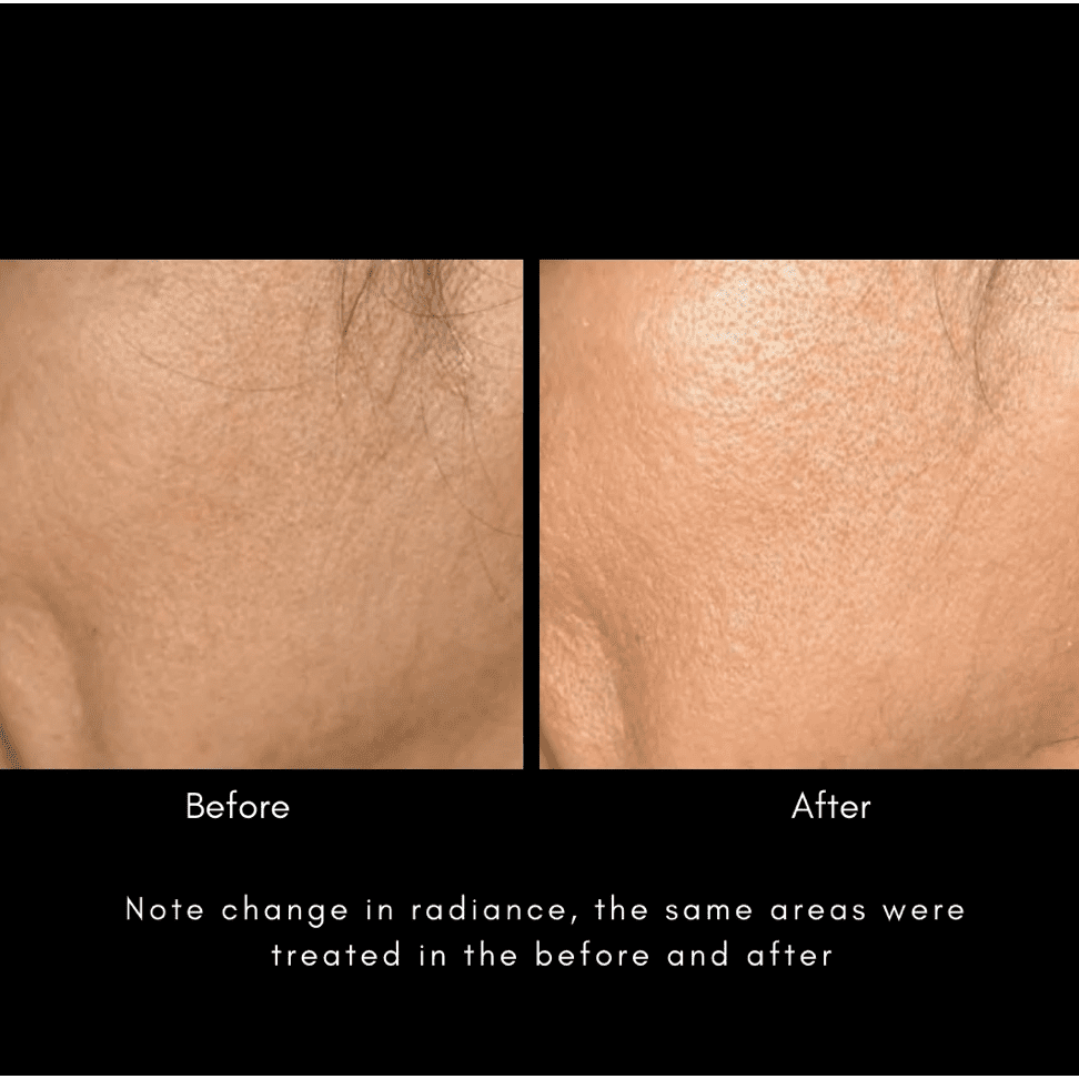 Maya Chia Advanced Response Complex | Regenerating Hydration Face & Neck Cream